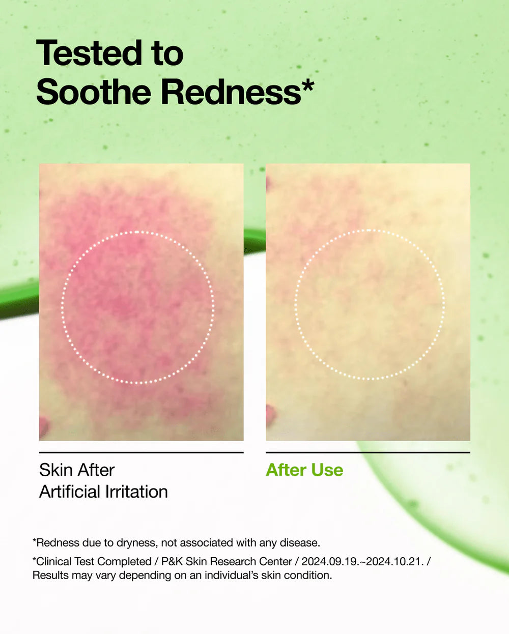 Azelaïnezuur 10 Hyaluron Roodheid Verzachtend Serum