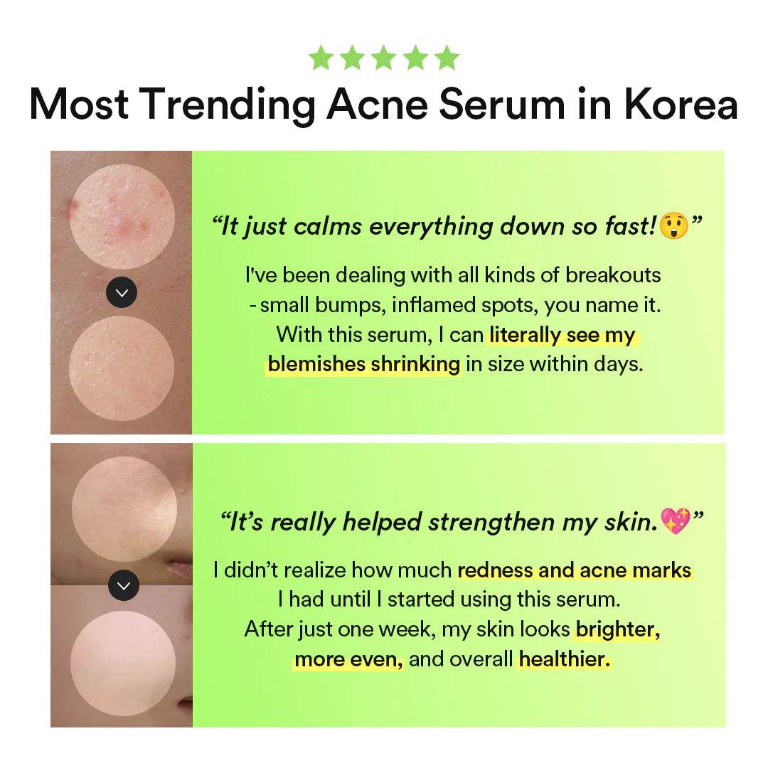 Heartleaf TECA Capsule Serum Calming Drop - K-beauty glow