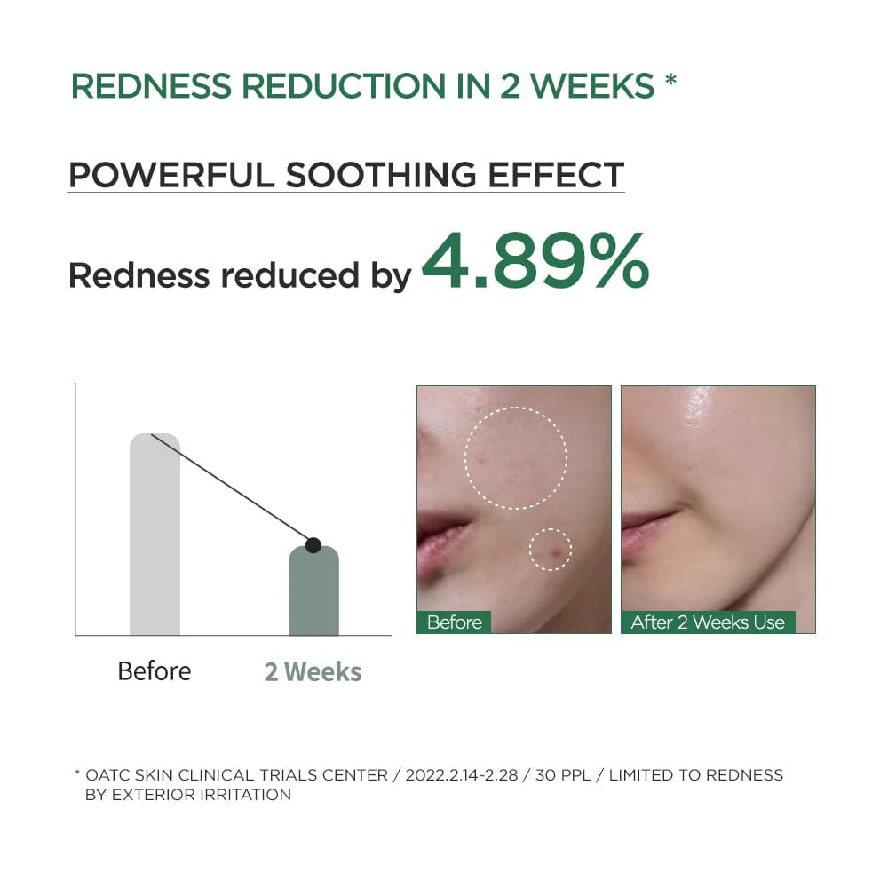Heartleaf 80% Moisture Verzachtende Ampul