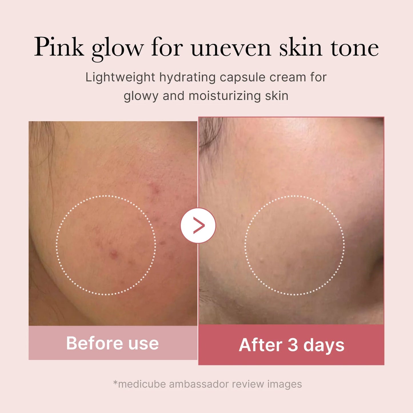 PDRN Roze Collageen Capsule Crème