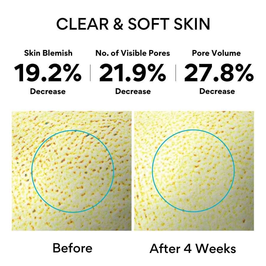 Retinol Cica Repair Ampoule - K-beauty glow