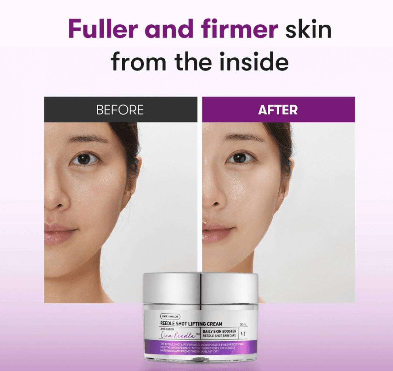 Reedle Shot Lifting Cream - K-beauty glow