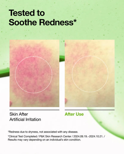 Azelaïnezuur 10 Hyaluron Roodheid Verzachtend Serum