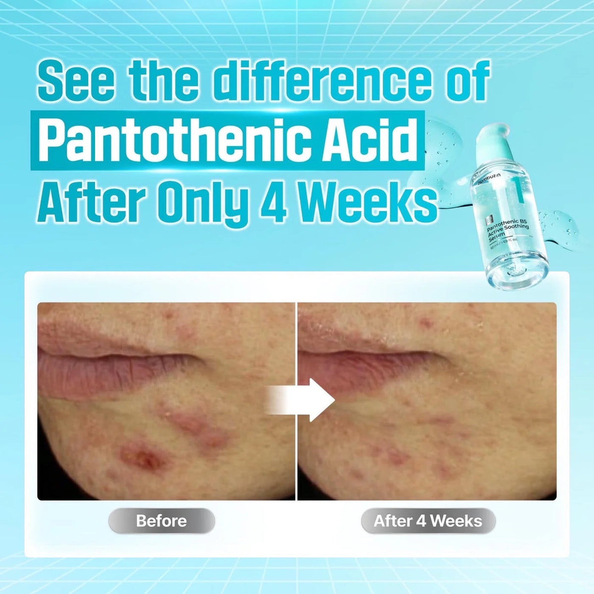 Nr.1 Pantothenic B5 Actief Verzachtend Serum