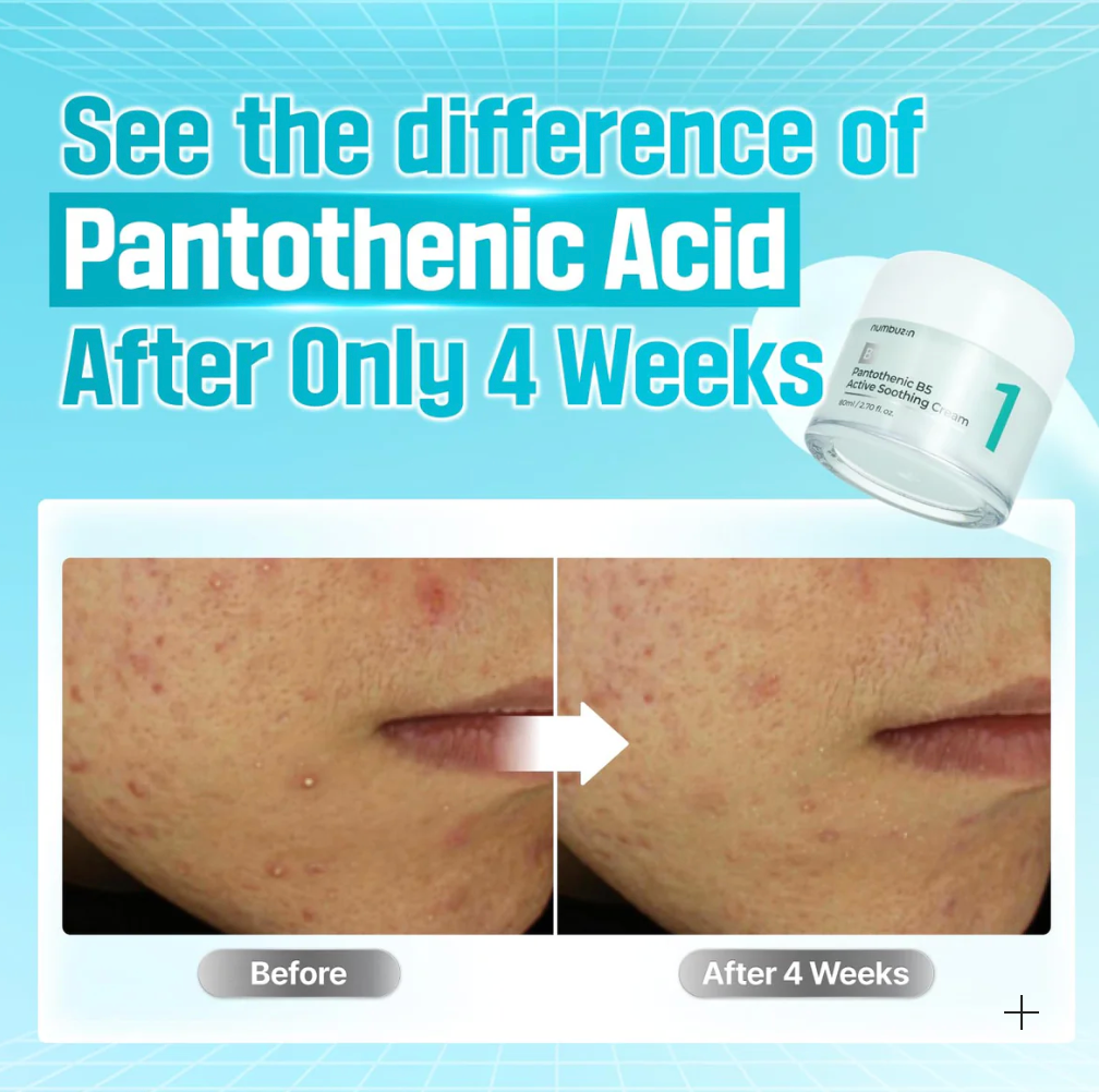 Nr. 1 Pantotheenzuur B5 Actieve Verzachtende Crème