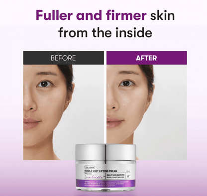 Reedle Shot Lifting Cream - K-beauty glow
