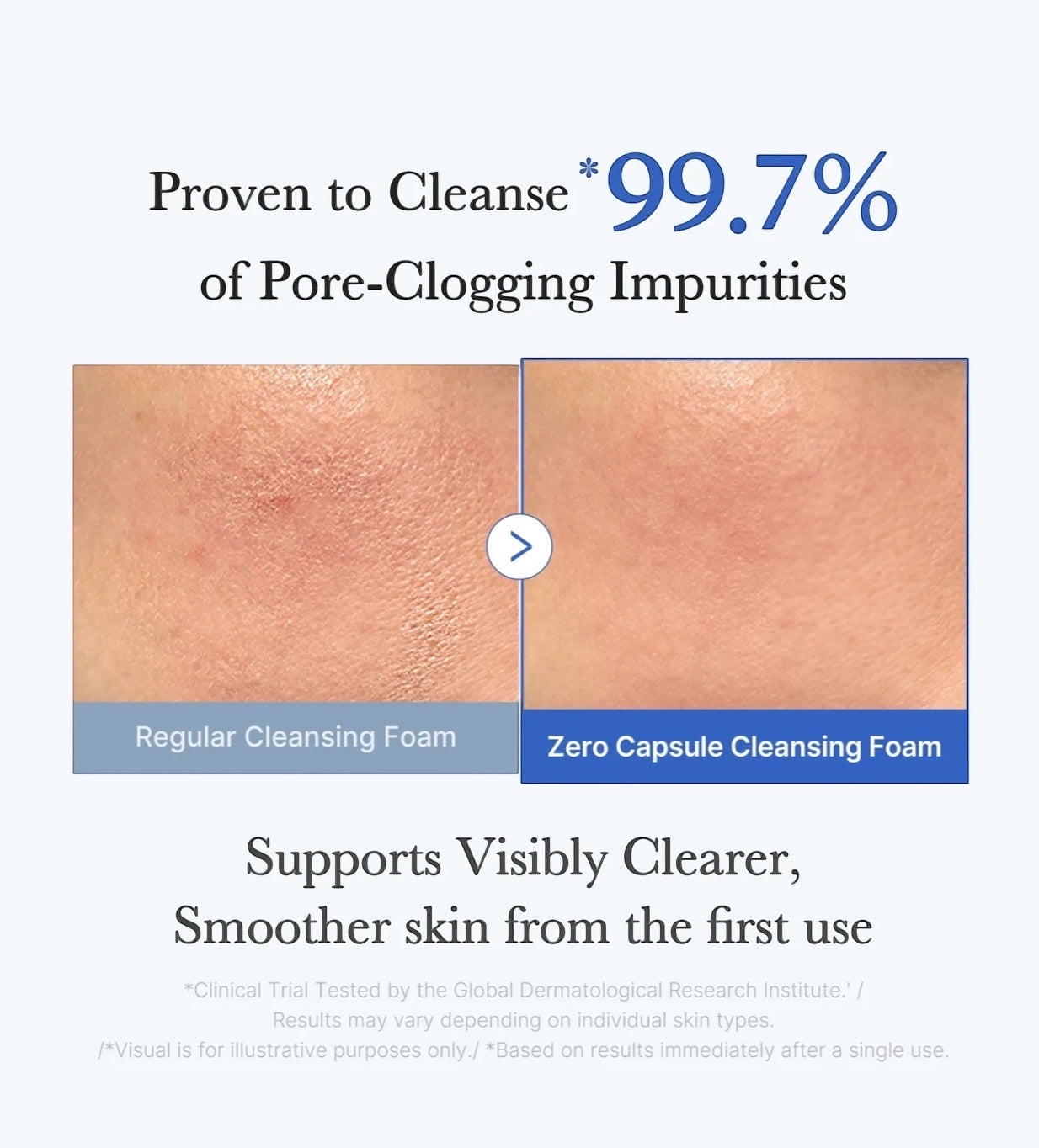 Zero Pore Capsule Cleansing Foam